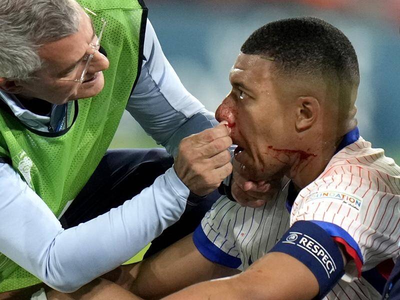 Kylian Mbappe receives medical attention after copping a broken nose in the win over Austria. (AP PHOTO)